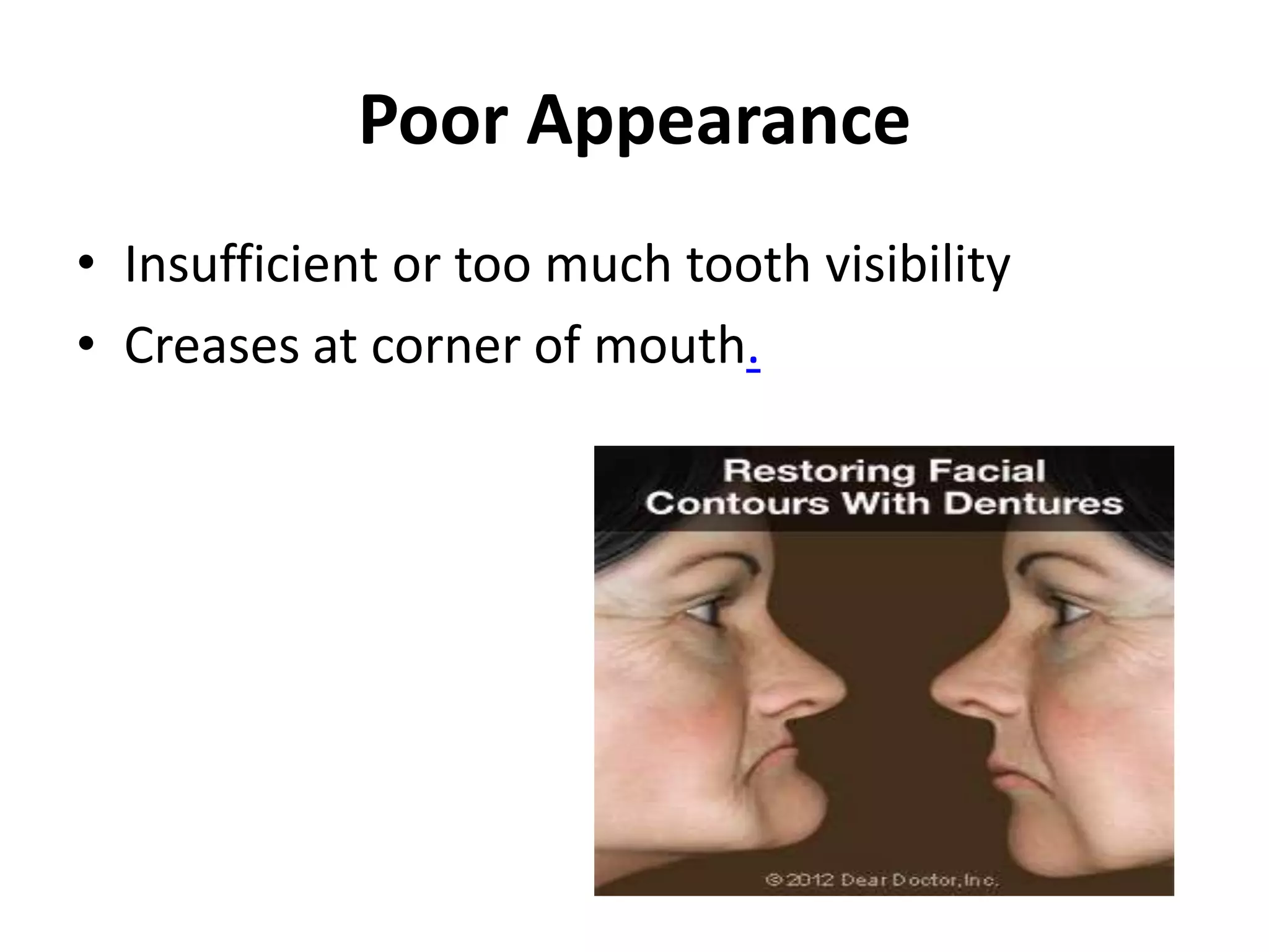 Poor Appearance
• Insufficient or too much tooth visibility
• Creases at corner of mouth.
 