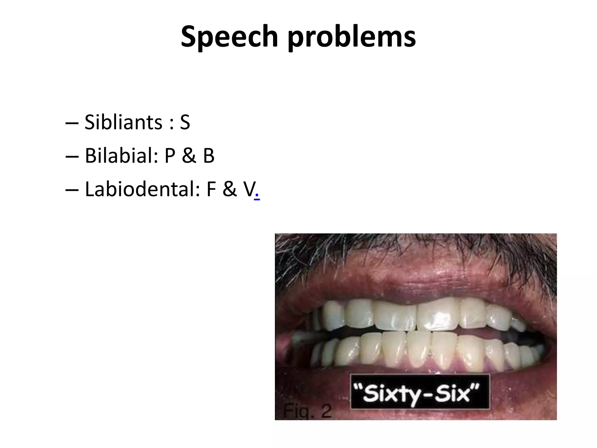 Speech problems
– Sibliants : S
– Bilabial: P & B
– Labiodental: F & V.
 