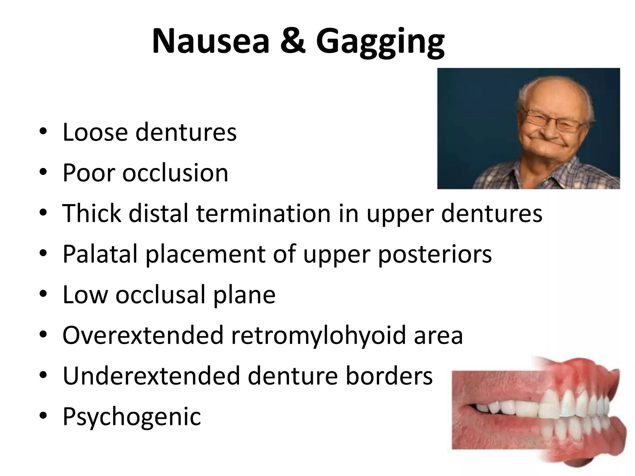 Nausea & Gagging
• Loose dentures
• Poor occlusion
• Thick distal termination in upper dentures
• Palatal placement of upper posteriors
• Low occlusal plane
• Overextended retromylohyoid area
• Underextended denture borders
• Psychogenic
 