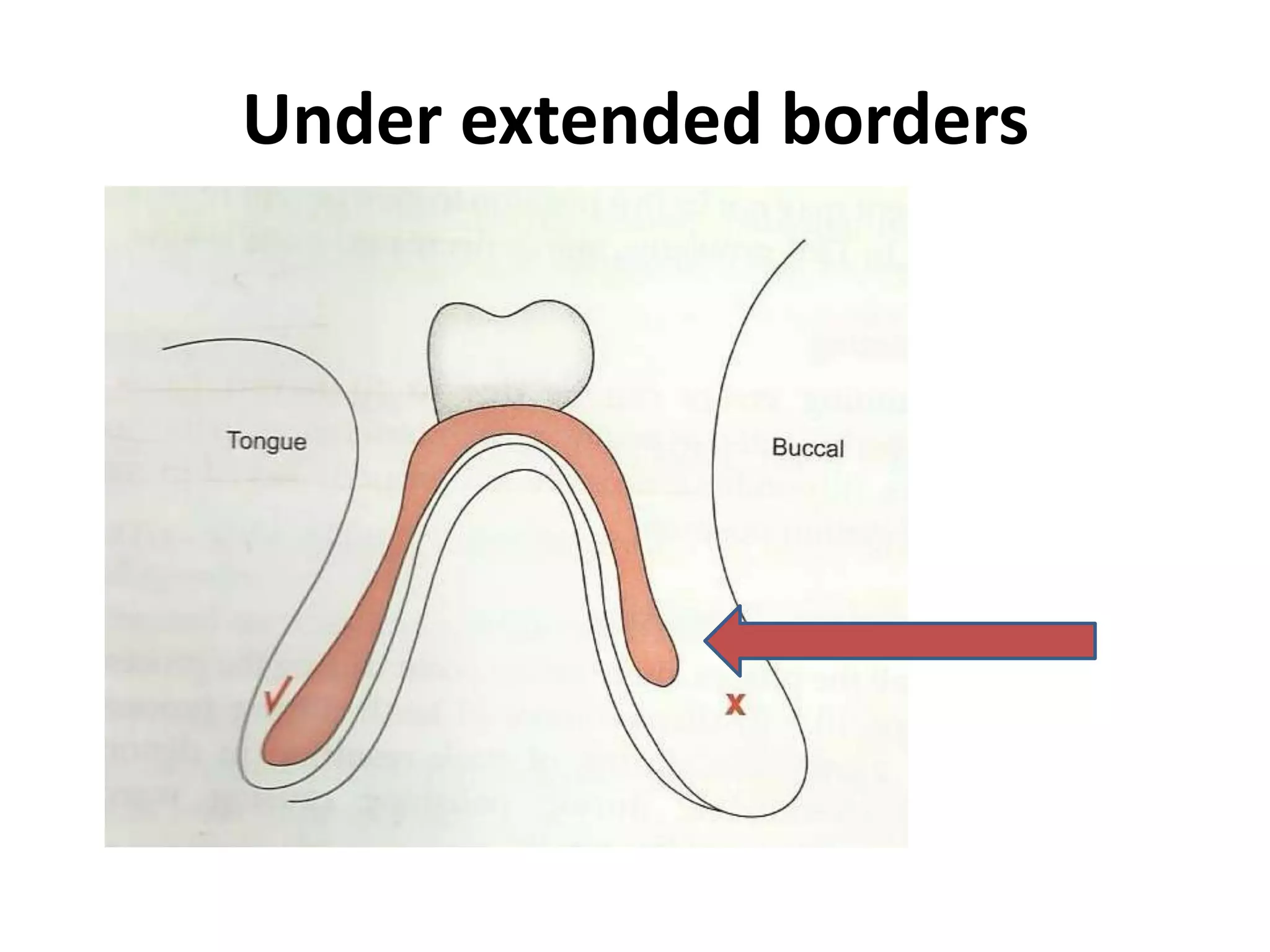 Under extended borders
 