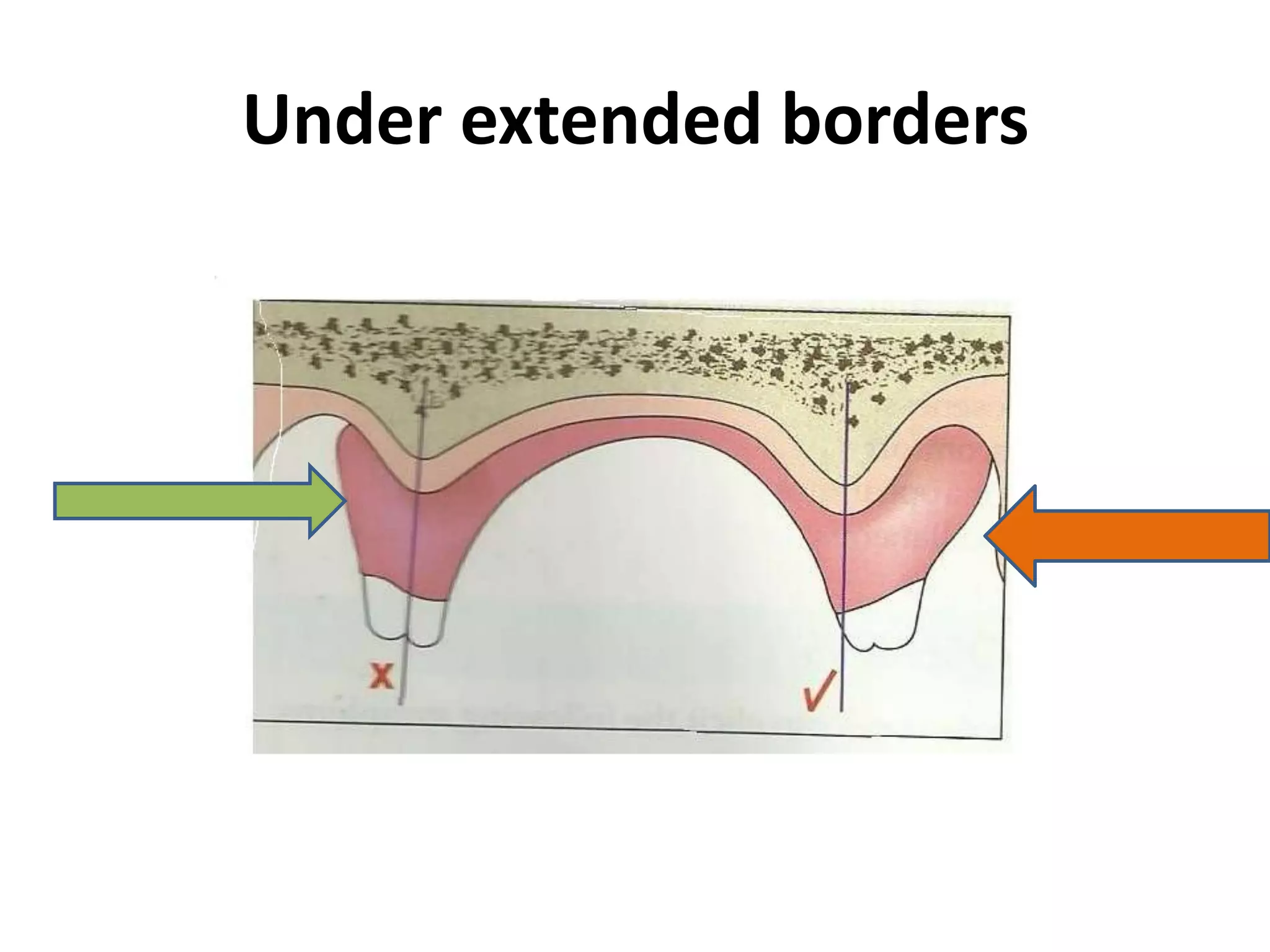 Under extended borders
 