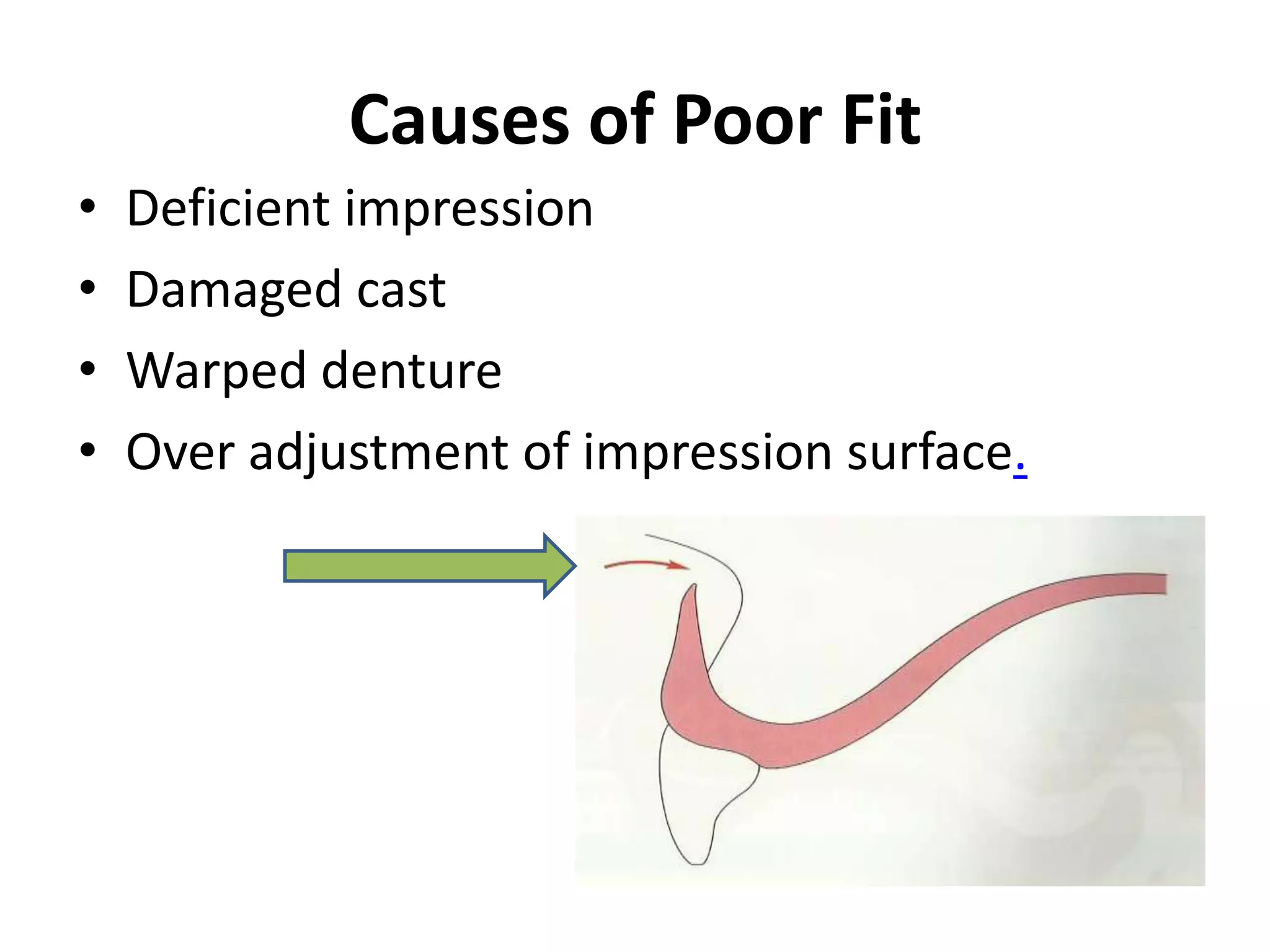 Causes of Poor Fit
• Deficient impression
• Damaged cast
• Warped denture
• Over adjustment of impression surface.
 