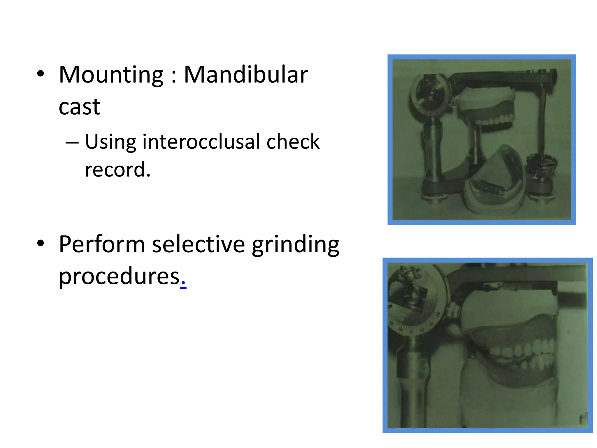 • Mounting : Mandibular
cast
– Using interocclusal check
record.
• Perform selective grinding
procedures.
 