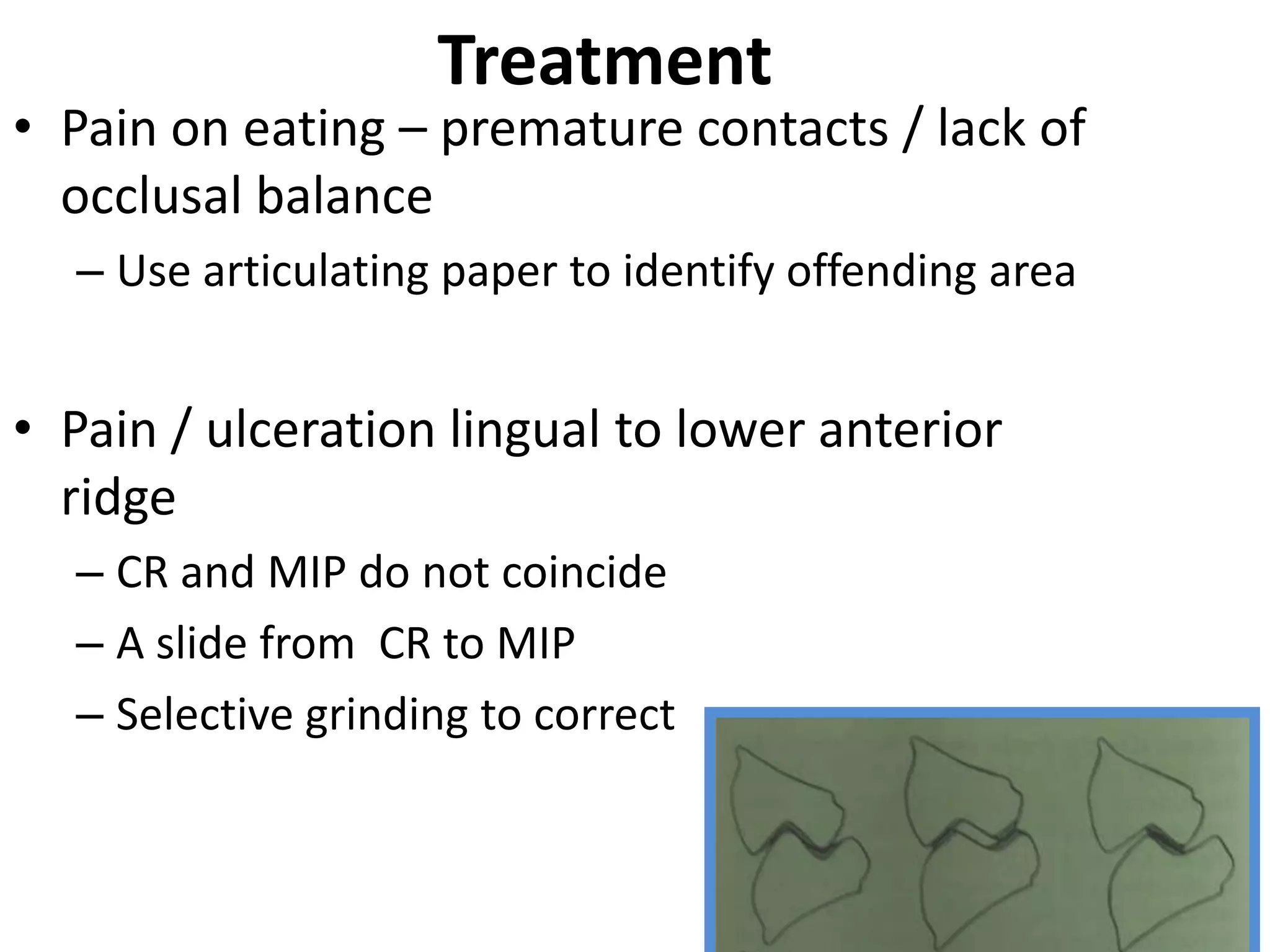 Treatment
• Pain on eating – premature contacts / lack of
occlusal balance
– Use articulating paper to identify offending area
• Pain / ulceration lingual to lower anterior
ridge
– CR and MIP do not coincide
– A slide from CR to MIP
– Selective grinding to correct
 