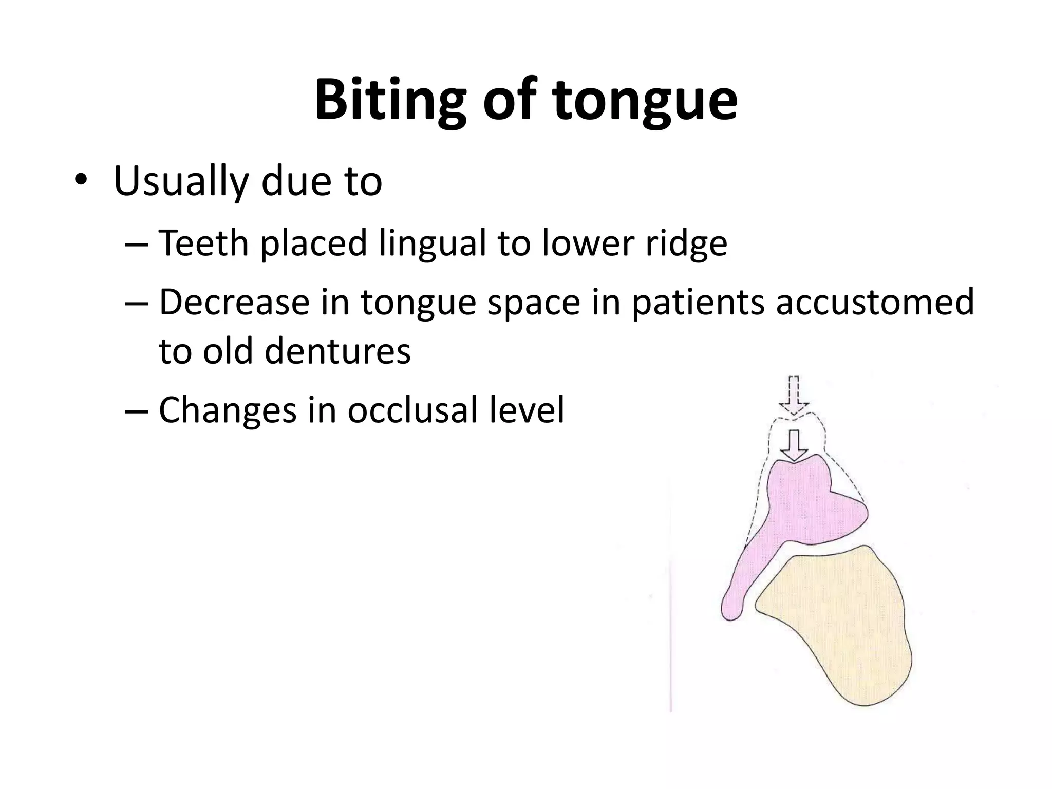 Biting of tongue
• Usually due to
– Teeth placed lingual to lower ridge
– Decrease in tongue space in patients accustomed
to old dentures
– Changes in occlusal level
 