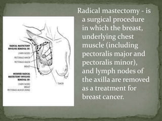 Radical mastectomy - is
a surgical procedure
in which the breast,
underlying chest
muscle (including
pectoralis major and
pectoralis minor),
and lymph nodes of
the axilla are removed
as a treatment for
breast cancer.
 