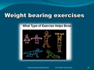 Postmenopausal Osteoporosis   Prof. Aslam LGH Lahore   20
 