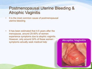 Postmenopausal uterine bleeding