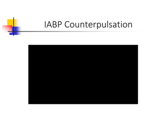 IABP Counterpulsation
 