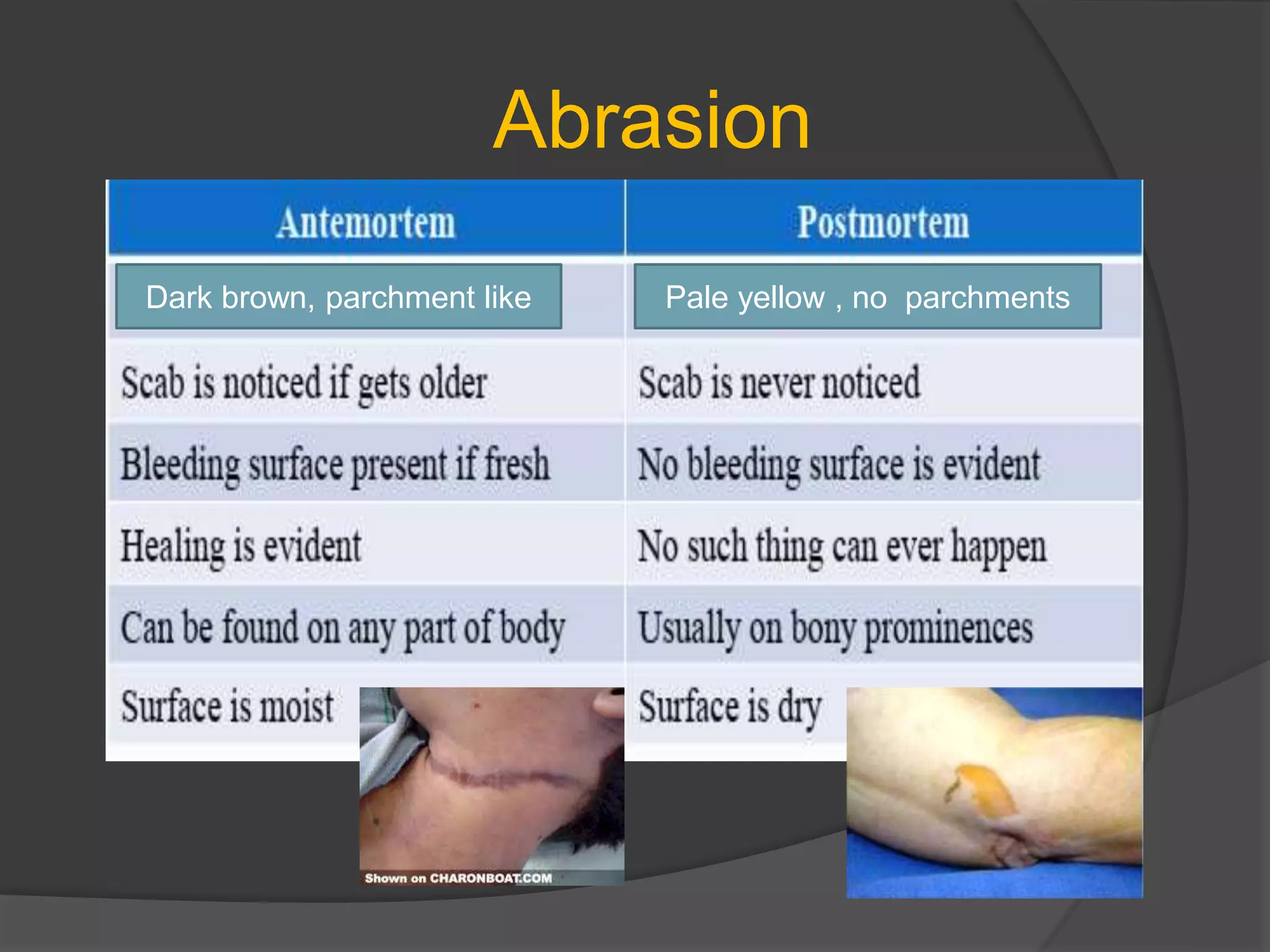 Postmortem artifacts - a Forensic perspective | PPTX