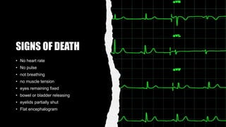 SIGNS OF DEATH
• No heart rate
• No pulse
• not breathing
• no muscle tension
• eyes remaining fixed
• bowel or bladder releasing
• eyelids partially shut
• Flat encephalogram
 