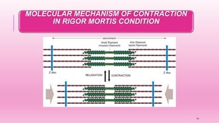 MOLECULAR MECHANISM OF CONTRACTION
IN RIGOR MORTIS CONDITION
14
 