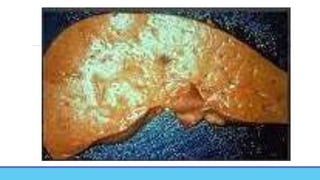 Post Mortem Changes in Forensic Medicine.new.pptx