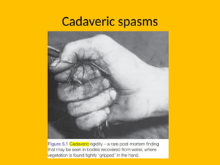 Cadaveric spasms
 