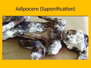 Adipocere (Saponification)
 