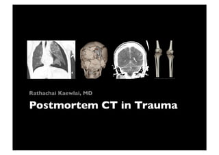 Postmortem CT in Trauma	

Rathachai Kaewlai, MD	

 