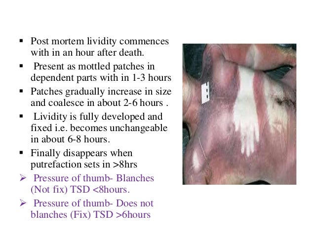 22 Ef 82 A7 Post Mortem Lividity Commences With In An Hour After 22 Ef 82 A7 Post Mortem Lividity Commences With In An Hour After