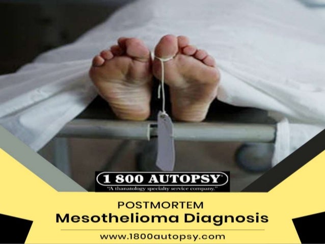 can you survive mesothelioma cancer