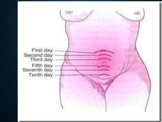 Postnatal Border Postnatal Care ppt | PPTX