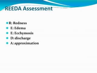REEDA Assessment
⚫R: Redness
⚫ E: Edema
⚫ E: Ecchymosis
⚫ D: discharge
⚫ A: approximation
 