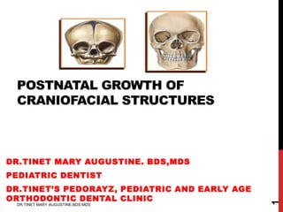 POSTNATAL GROWTH OF
CRANIOFACIAL STRUCTURES
DR.TINET MARY AUGUSTINE. BDS,MDS
PEDIATRIC DENTIST
DR.TINET’S PEDORAYZ, PEDIATRIC AND EARLY AGE
ORTHODONTIC DENTAL CLINIC
DR.TINET MARY AUGUSTINE.BDS MDS
1
 