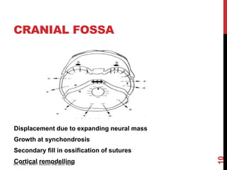 Postnatal growth of cranio facial structures | PDF