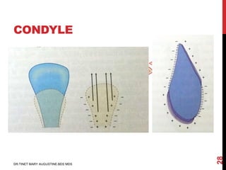 Condyle Lift Postnatal growth of cranio facial structures | PDF