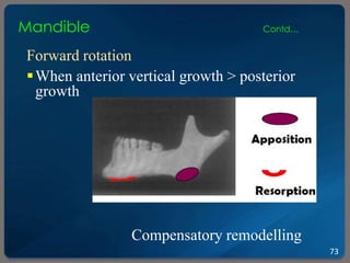 Postnatal growth of face | PPTX