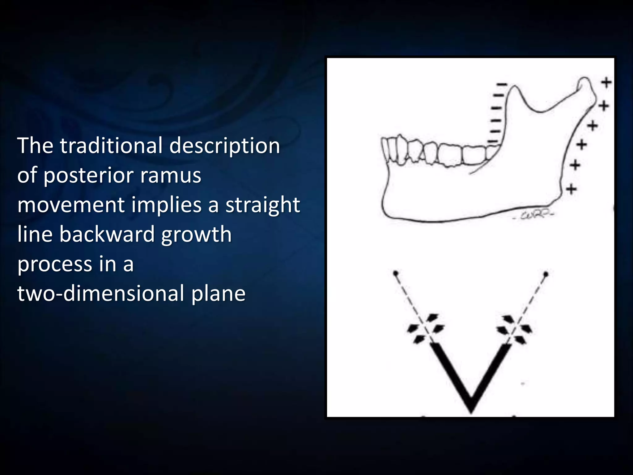 Postnatal growth of mandible | PPT