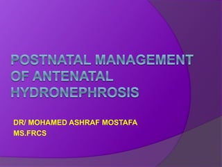 DR/ MOHAMED ASHRAF MOSTAFA
MS.FRCS
 