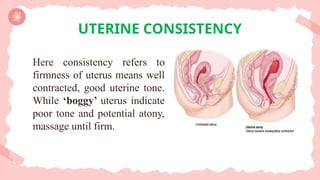 Here consistency refers to
firmness of uterus means well
contracted, good uterine tone.
While ‘boggy’ uterus indicate
poor tone and potential atony,
massage until firm.
UTERINE CONSISTENCY
 