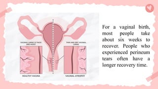 For a vaginal birth,
most people take
about six weeks to
recover. People who
experienced perineum
tears often have a
longer recovery time.
 