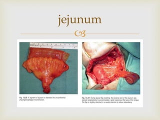 jejunum 
 
 