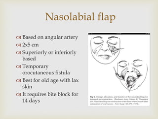 Nasolabial flap 
 Based on angular artery 
 2x5 cm 
 Superiorly or inferiorly 
based 
 Temporary 
orocutaneous fistula 
 Best for old age with lax 
skin 
 It requires bite block for 
14 days 
 