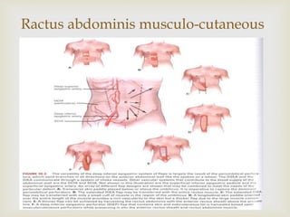 Ractus abdominis musculo-cutaneous 
 
 