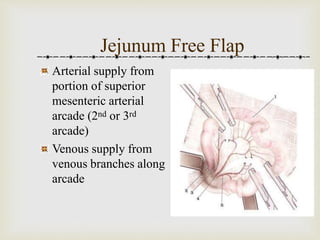 Jejunum Free Flap 
Arterial supply from 
portion of superior 
mesenteric arterial 
arcade (2nd or 3rd 
arcade) 
Venous supply from 
venous branches along 
arcade 
 