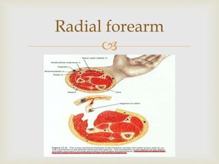 Radial forearm 
 
 