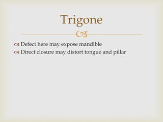 Trigone 
 
 Defect here may expose mandible 
 Direct closure may distort tongue and pillar 
 