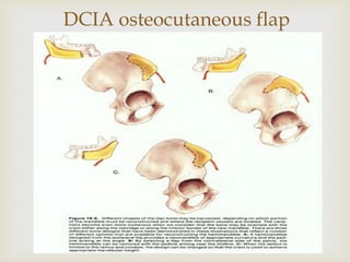 DCIA osteocutaneous flap 
 