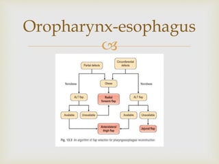 Oropharynx-esophagus 
 
 