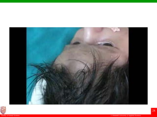 © Ramaiah University of Applied Sciences
28
Faculty of Dental Sciences
 