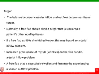 © Ramaiah University of Applied Sciences
31
Faculty of Dental Sciences
Turgor
• The balance between vascular inﬂow and outﬂow determines tissue
turgor.
• Normally, a free ﬂap should exhibit turgor that is similar to a
patient’s other nonﬂap tissues.
• If a free ﬂap exhibits diminished turgor, this may herald an arterial
inﬂow problem.
• Increased prominence of rhytids (wrinkles) on the skin paddle-
arterial inflow problem
• A free ﬂap that is excessively swollen and ﬁrm may be experiencing
a venous outﬂow problem.
 