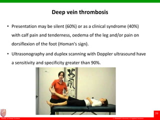 © Ramaiah University of Applied Sciences
59
Faculty of Dental Sciences
Deep vein thrombosis
• Presentation may be silent (60%) or as a clinical syndrome (40%)
with calf pain and tenderness, oedema of the leg and/or pain on
dorsiflexion of the foot (Homan's sign).
• Ultrasonography and duplex scanning with Doppler ultrasound have
a sensitivity and specificity greater than 90%.
 