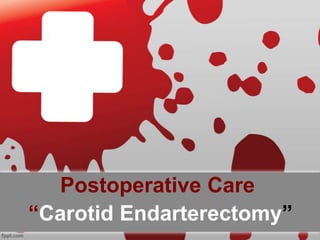Postoperative Care
“Carotid Endarterectomy”
 