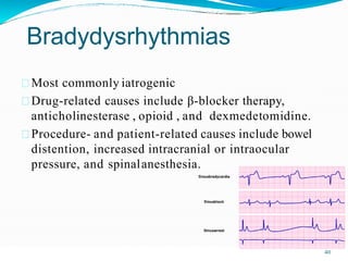 Bradydysrhythmias
Most commonly iatrogenic
Drug-related causes include β-blocker therapy,
anticholinesterase , opioid , and dexmedetomidine.
Procedure- and patient-related causes include bowel
distention, increased intracranial or intraocular
pressure, and spinalanesthesia.
40
 