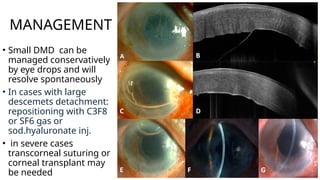 POST OP COMPLICATIONS OF CATARACT SURGERY.pptx