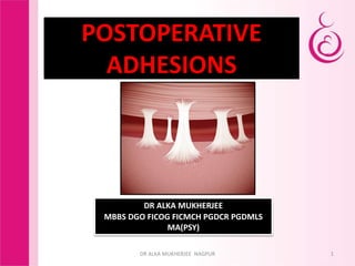 1
POSTOPERATIVE
ADHESIONS
DR ALKA MUKHERJEE
MBBS DGO FICOG FICMCH PGDCR PGDMLS
MA(PSY)
DR ALKA MUKHERJEE NAGPUR
 