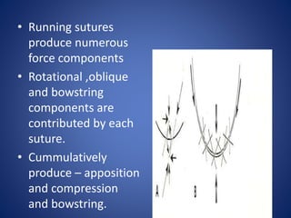 • Running sutures
produce numerous
force components
• Rotational ,oblique
and bowstring
components are
contributed by each
suture.
• Cummulatively
produce – apposition
and compression
and bowstring.
 