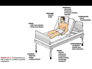 Postoperative complications and management | PPTX