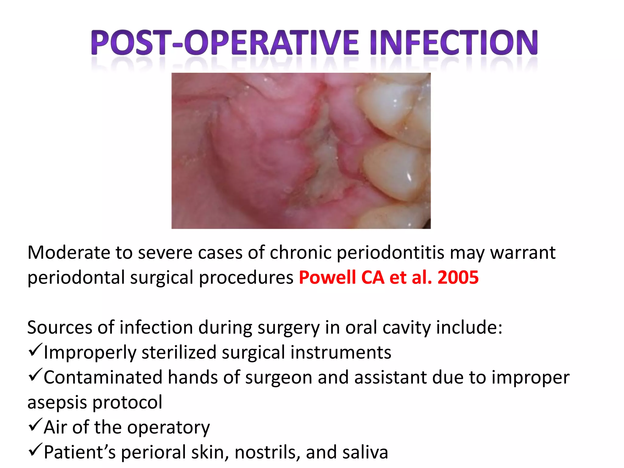 Post Operative Infection Post operative complications of periodontal surgery | PDF